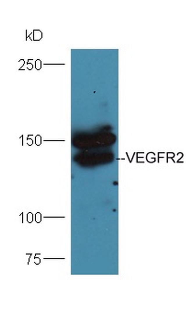 VEGFR2 Antibody in Western Blot (WB)