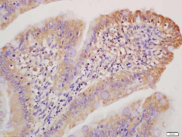 Collagen 1 Antibody in Immunohistochemistry (Paraffin) (IHC (P))