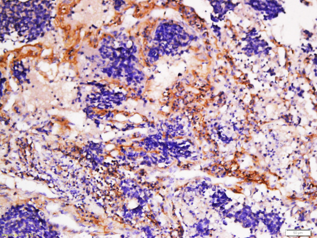 Collagen 1 Antibody in Immunohistochemistry (Paraffin) (IHC (P))