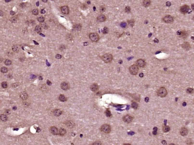 Collagen 1 Antibody in Immunohistochemistry (Paraffin) (IHC (P))