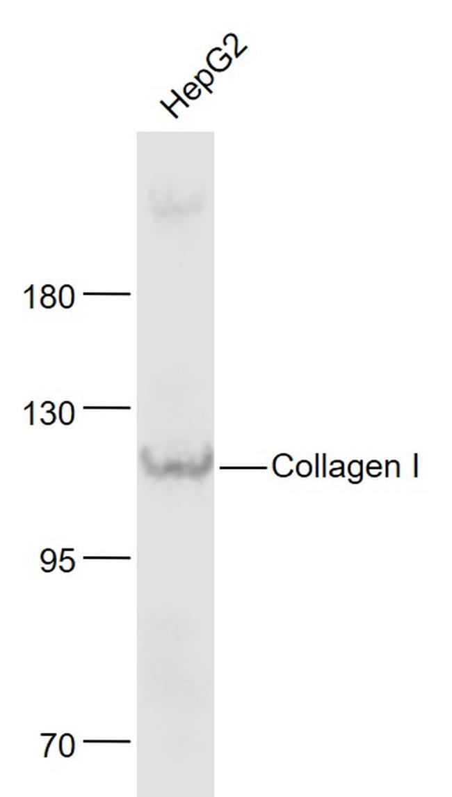 Collagen 1 Antibody in Western Blot (WB)