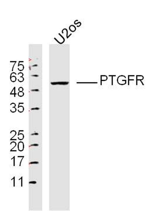 PTGFR Antibody in Western Blot (WB)