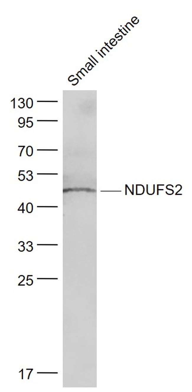 NDUFS2 Antibody in Western Blot (WB)