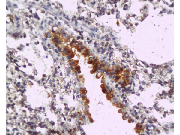 MyD88 Antibody in Immunohistochemistry (Paraffin) (IHC (P))