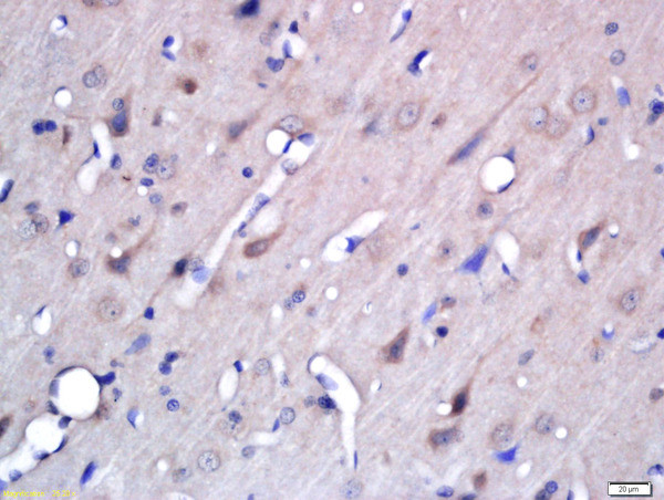 BACE2 Antibody in Immunohistochemistry (Paraffin) (IHC (P))