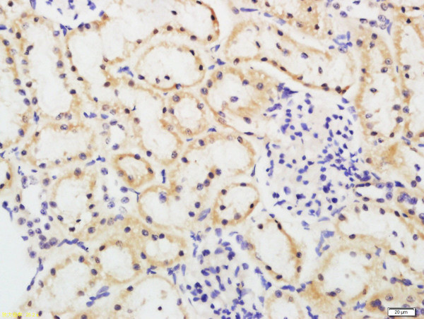 FBXO42 Antibody in Immunohistochemistry (Paraffin) (IHC (P))