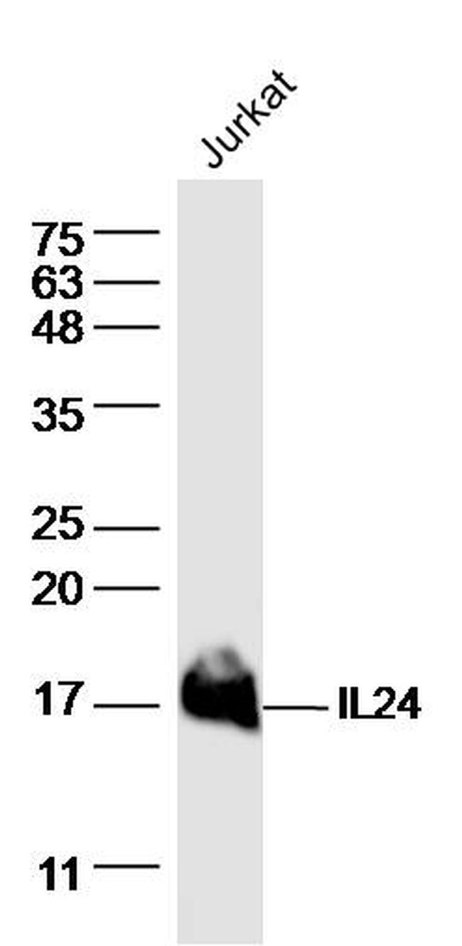 IL24 Antibody in Western Blot (WB)