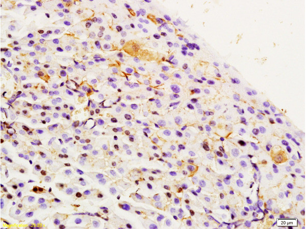 Integrin Alpha 3 + Beta 1 Antibody in Immunohistochemistry (Paraffin) (IHC (P))