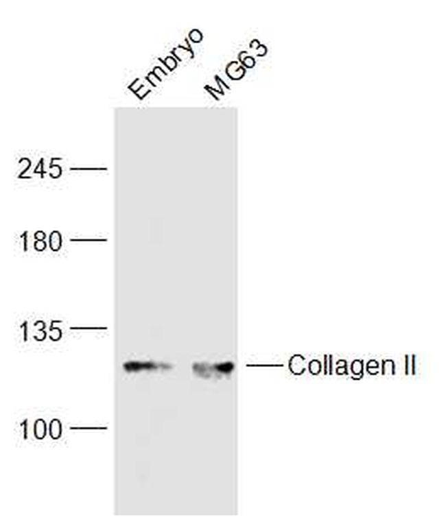 Collagen alpha-1(II) chain Antibody in Western Blot (WB)