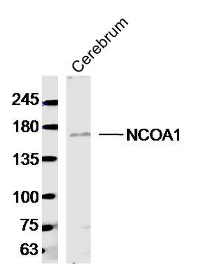 NCOA1 Antibody in Western Blot (WB)