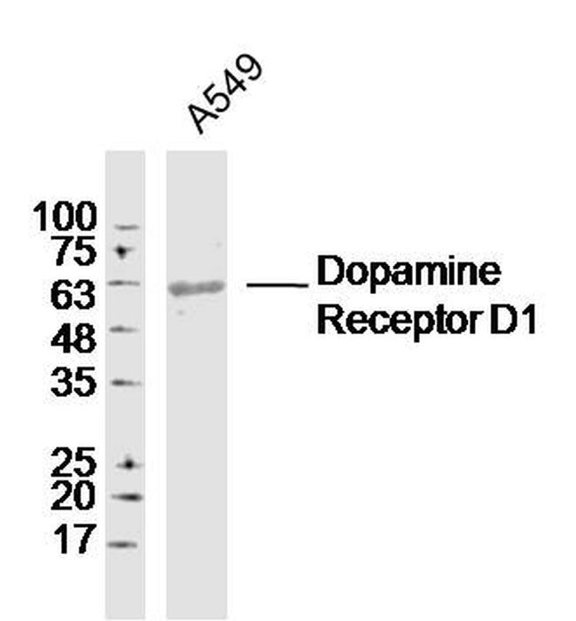 Dopamine Receptor D1 Antibody in Western Blot (WB)