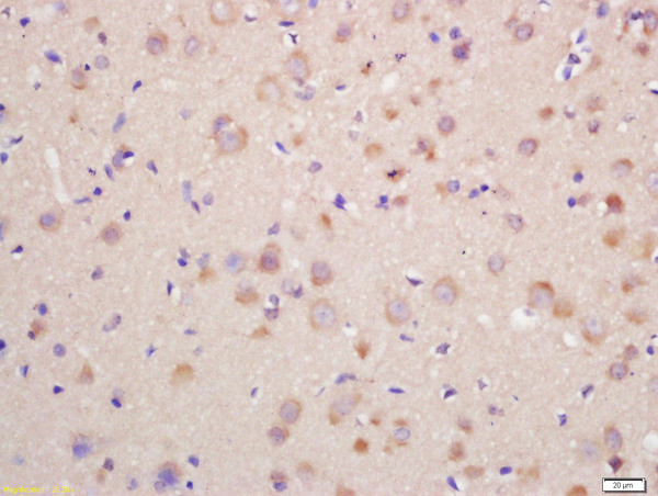 Dopamine D1 Receptor Antibody in Immunohistochemistry (Paraffin) (IHC (P))