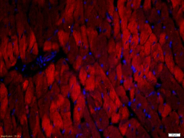 Troponin T Antibody in Immunohistochemistry (Paraffin) (IHC (P))