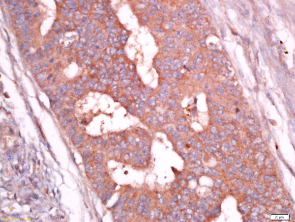 Troponin T Antibody in Immunohistochemistry (Paraffin) (IHC (P))