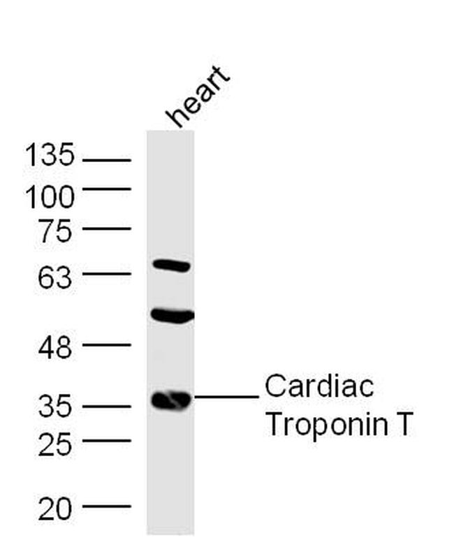 Troponin T Antibody in Western Blot (WB)