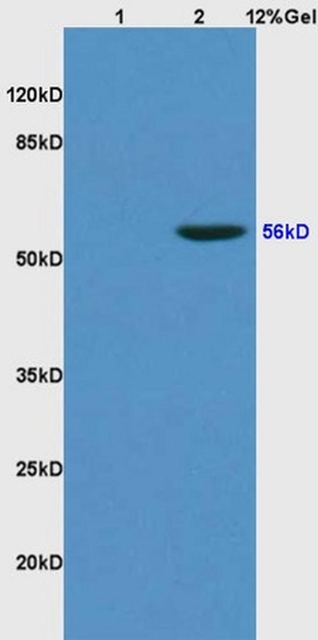 KLF2/4 Antibody in Western Blot (WB)