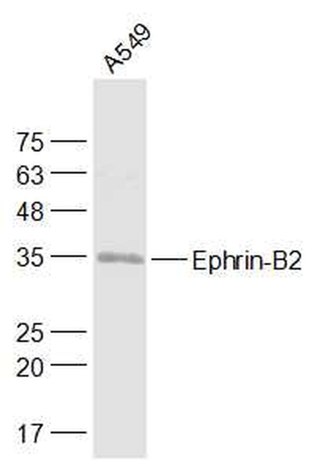 Ephrin-B2 Antibody in Western Blot (WB)