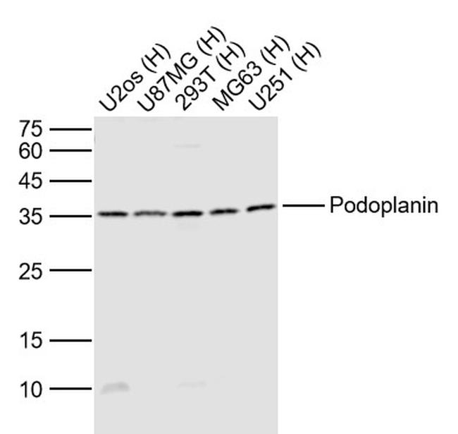 Podoplanin Antibody in Western Blot (WB)