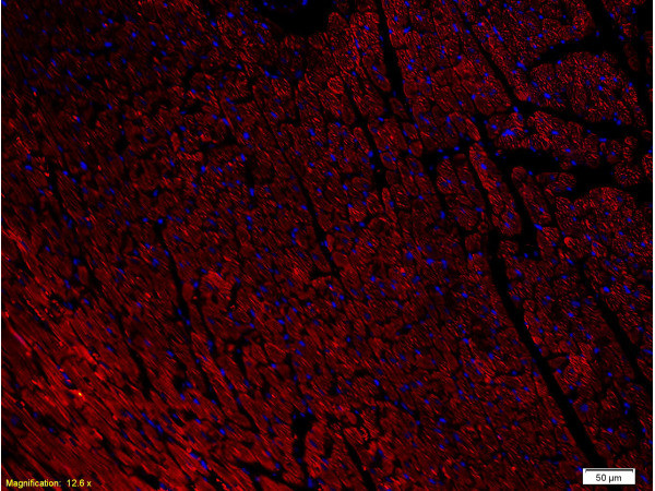 NPY1R Antibody in Immunohistochemistry (Paraffin) (IHC (P))