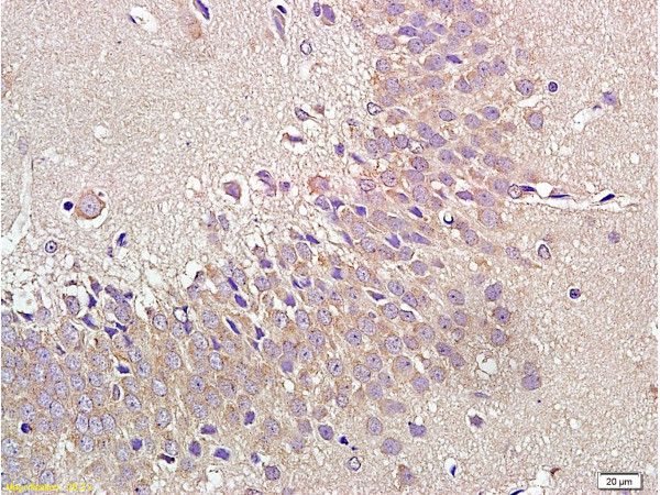 NPY1R Antibody in Immunohistochemistry (Paraffin) (IHC (P))