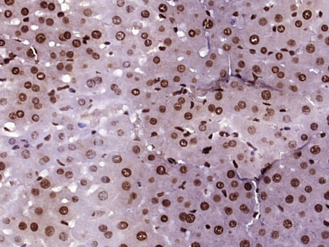 Acetyl-Histone H4 (Lys5) Antibody in Immunohistochemistry (Paraffin) (IHC (P))