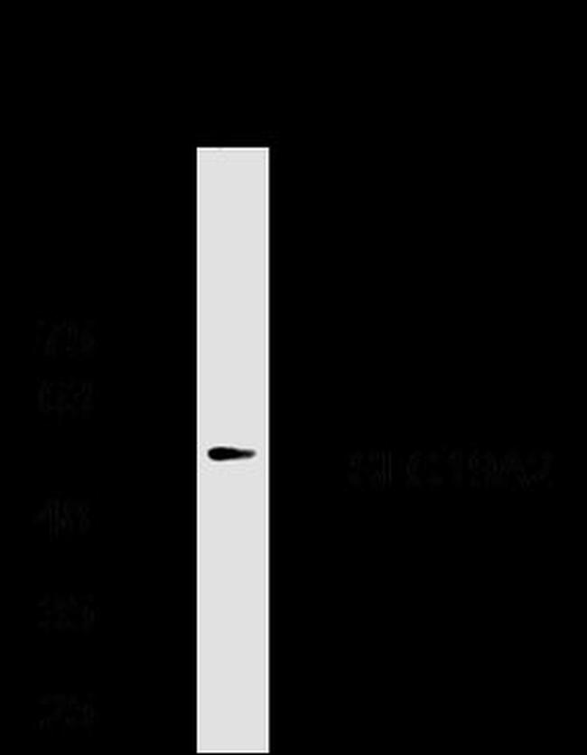 SLC19A2 Antibody in Western Blot (WB)