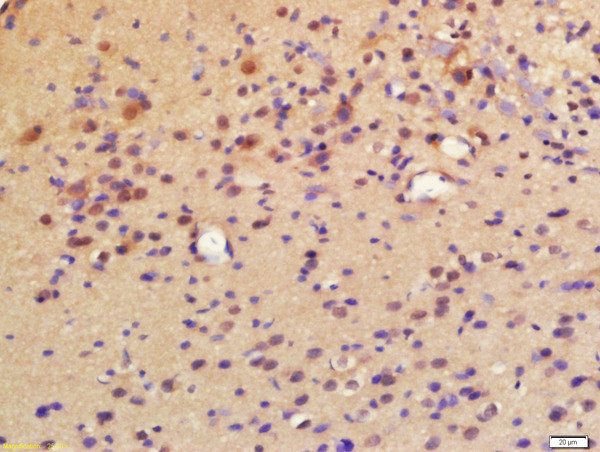 LPCAT2 Antibody in Immunohistochemistry (Paraffin) (IHC (P))