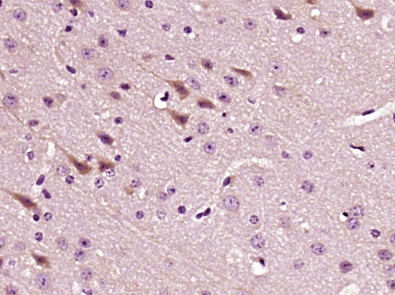 LPCAT2 Antibody in Immunohistochemistry (Paraffin) (IHC (P))