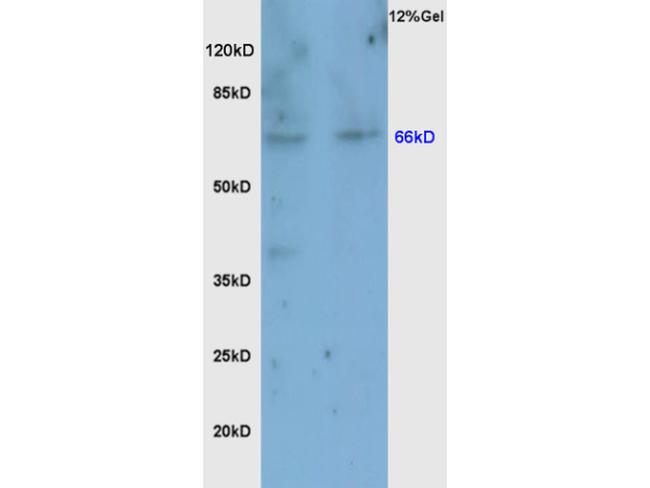 Nrf2 Antibody in Western Blot (WB)