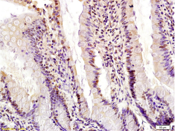 Egr1 Antibody in Immunohistochemistry (Paraffin) (IHC (P))