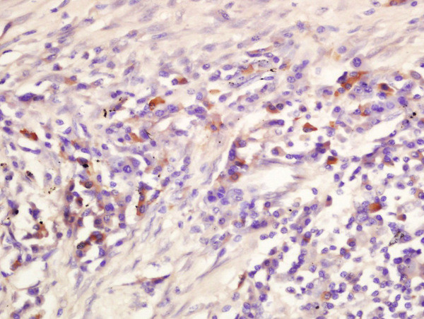 ADORA2B Antibody in Immunohistochemistry (Paraffin) (IHC (P))