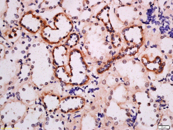 ADRB3 Antibody in Immunohistochemistry (Paraffin) (IHC (P))