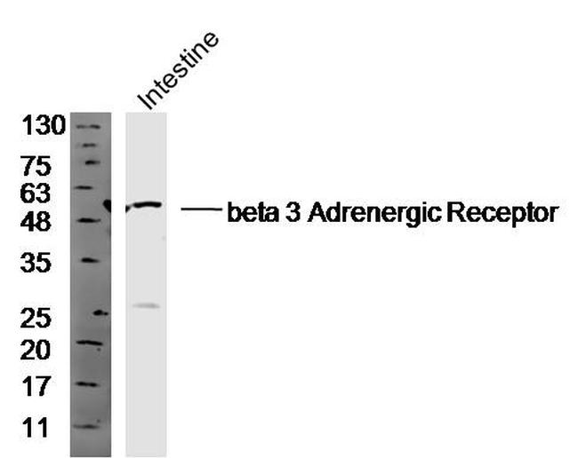 ADRB3 Antibody in Western Blot (WB)