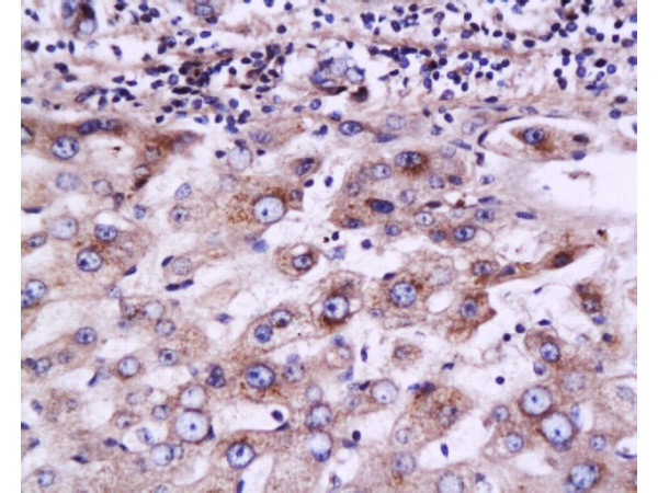 MRP2 Antibody in Immunohistochemistry (Paraffin) (IHC (P))