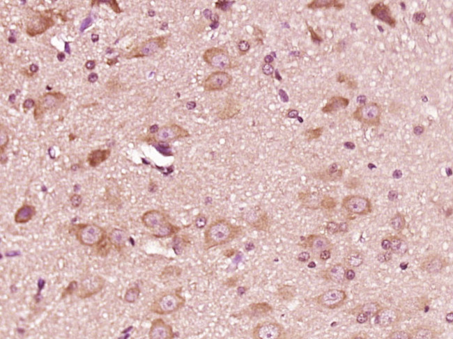 ATP6V1G2 Antibody in Immunohistochemistry (Paraffin) (IHC (P))