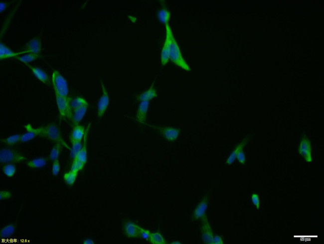 CHI3L1 Antibody in Immunocytochemistry (ICC/IF)