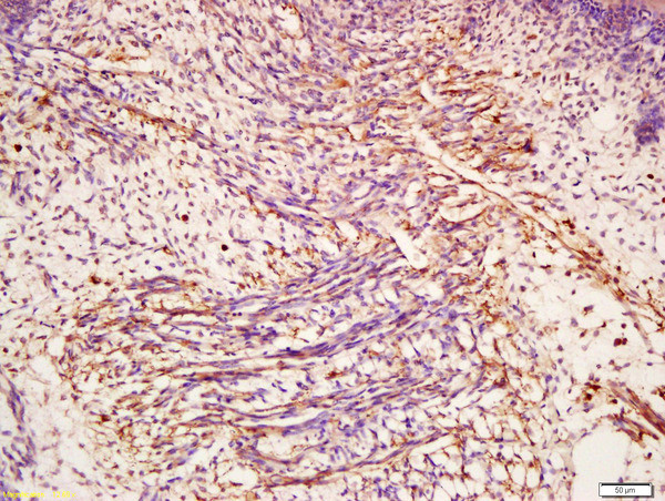 CHI3L1 Antibody in Immunohistochemistry (Paraffin) (IHC (P))