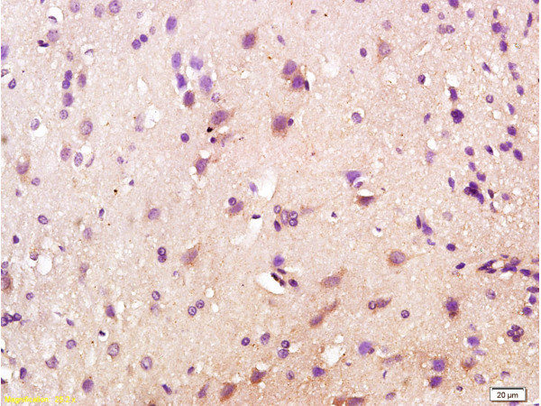 Orexin receptor 1+2 Antibody in Immunohistochemistry (Paraffin) (IHC (P))