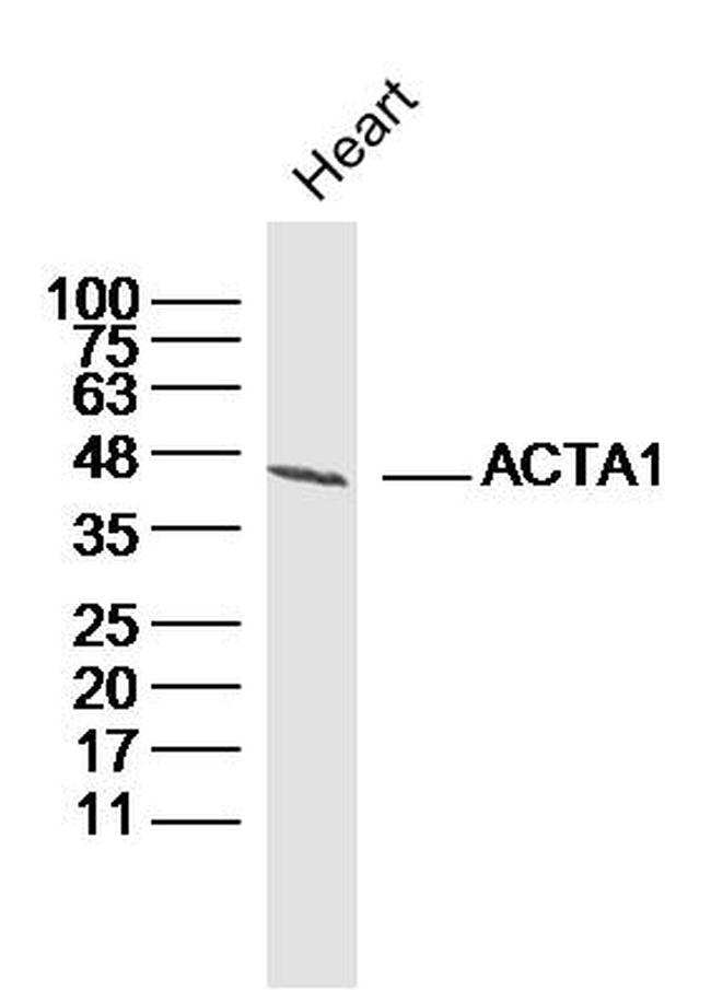 Actin Antibody in Western Blot (WB)