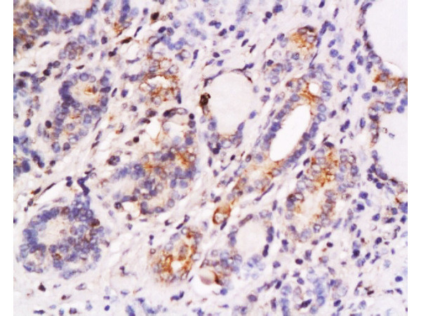 SKP2 Antibody in Immunohistochemistry (Paraffin) (IHC (P))