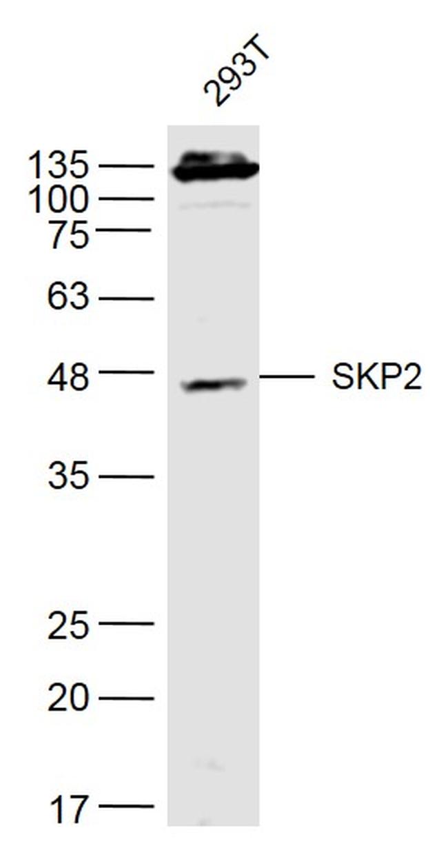 SKP2 Antibody in Western Blot (WB)