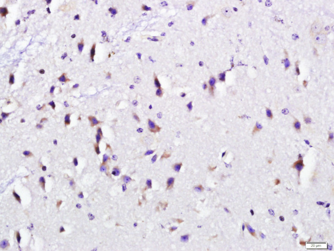 RCAS1/EBAG9 Antibody in Immunohistochemistry (Paraffin) (IHC (P))