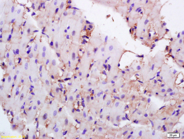 CD36 Antibody in Immunohistochemistry (Paraffin) (IHC (P))