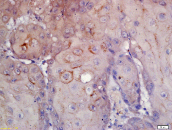 CD276/B7H3 Antibody in Immunohistochemistry (Paraffin) (IHC (P))