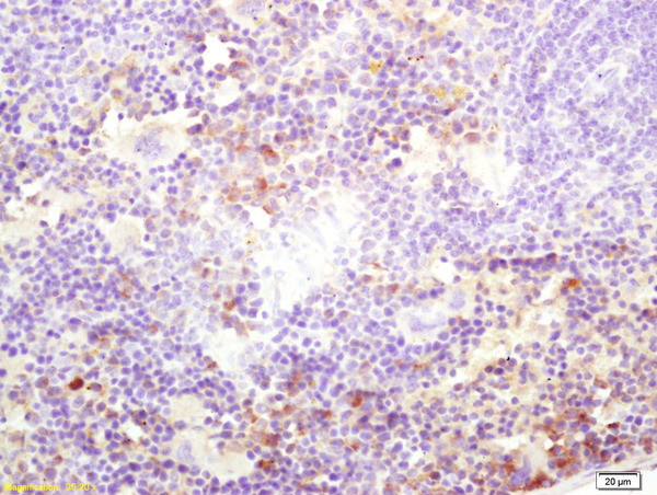 Kinesin Antibody in Immunohistochemistry (Paraffin) (IHC (P))