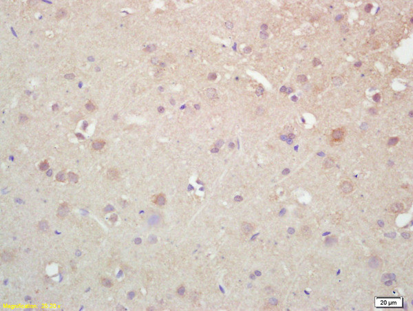 K5A/NKHC1 Antibody in Immunohistochemistry (Paraffin) (IHC (P))