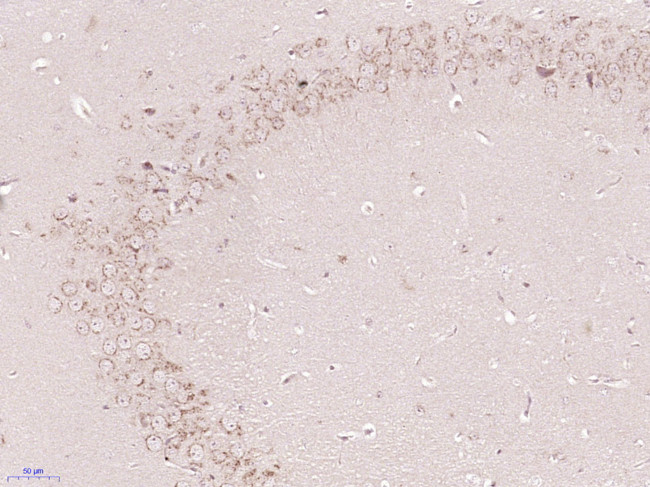 Gliomedin Antibody in Immunohistochemistry (Paraffin) (IHC (P))