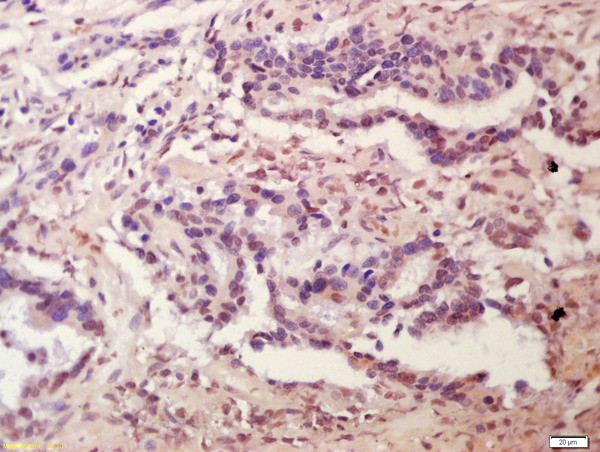 Plakophilin 2 Antibody in Immunohistochemistry (Paraffin) (IHC (P))