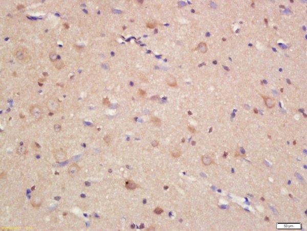 JAMC Antibody in Immunohistochemistry (Paraffin) (IHC (P))