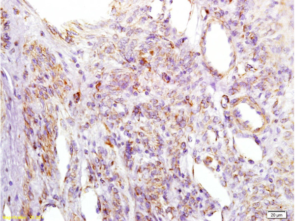 IGFBP2 Antibody in Immunohistochemistry (Paraffin) (IHC (P))